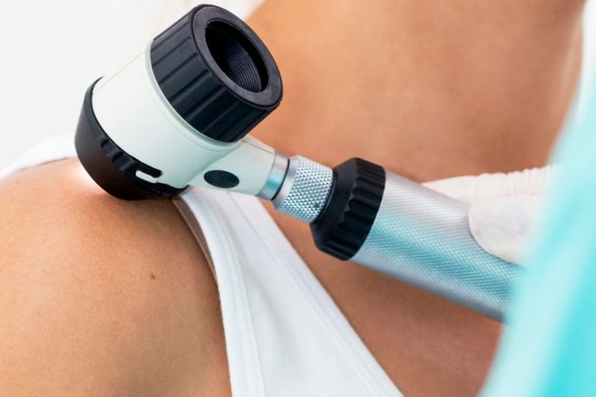 Skin Cancer Screening